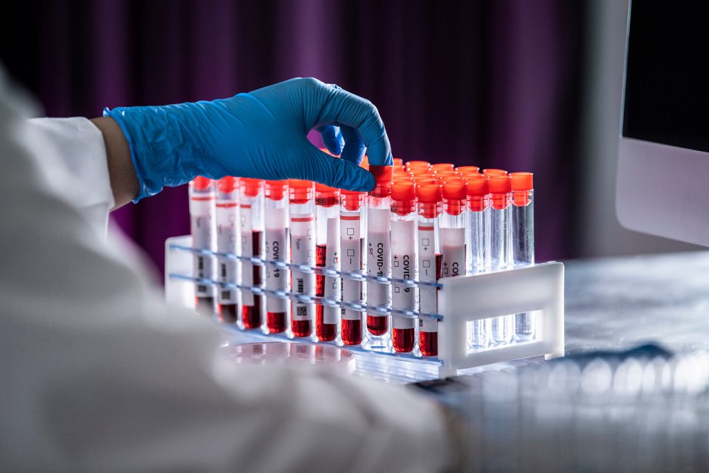 Hematology-1-1024x683