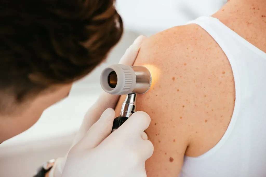 cropped view of dermatologist in latex gloves holding dermatoscope while examining patient with skin