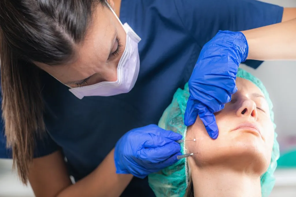 Face lifting Mesotherapy Treatment with Meso Threads