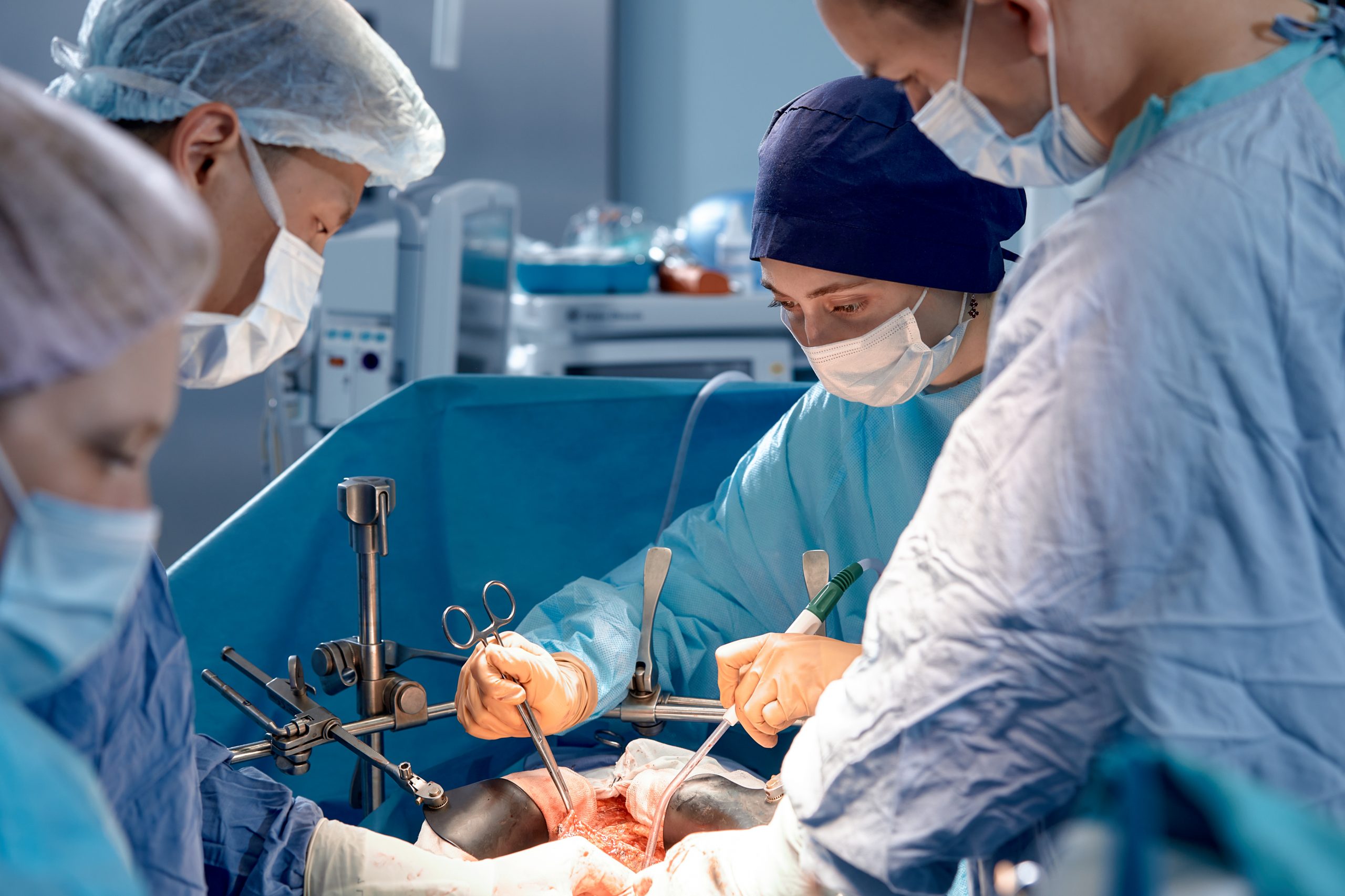 Team of surgeons carefully performing surgery using precise instruments in the operating room save the life of the patient, clear teamwork.