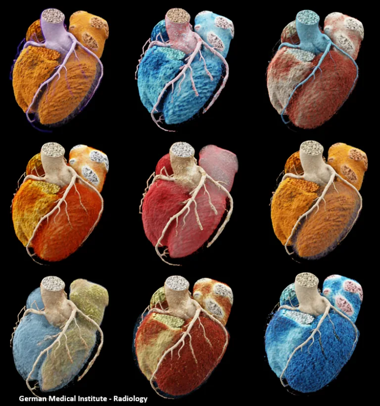 cardiac2-768x822
