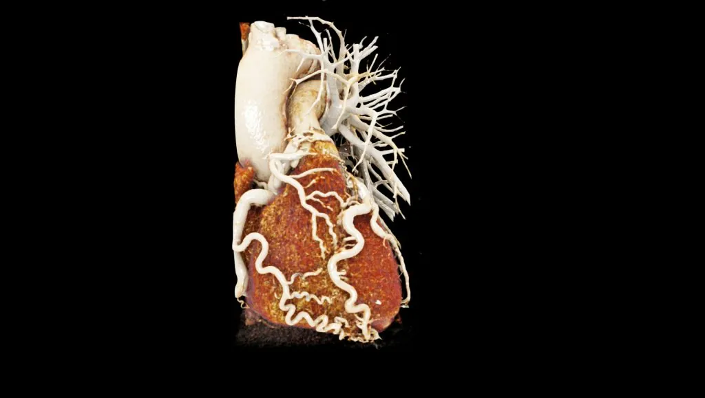 cardiacthoracic1