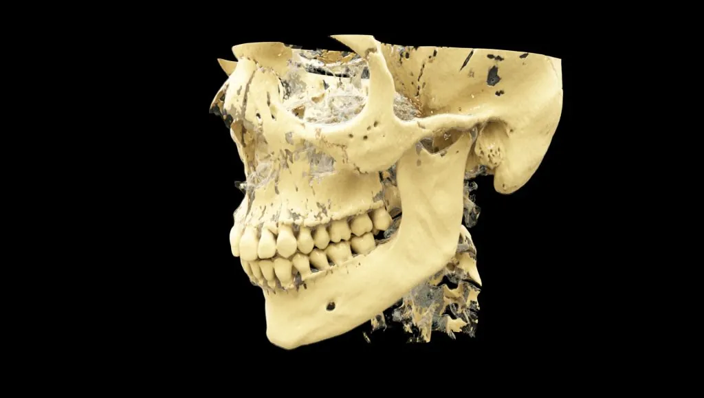 ct-dental1