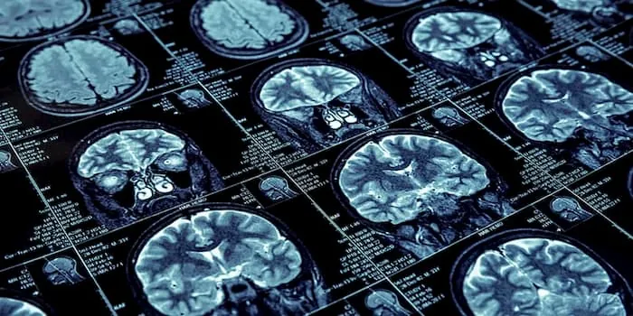 D-Neurology