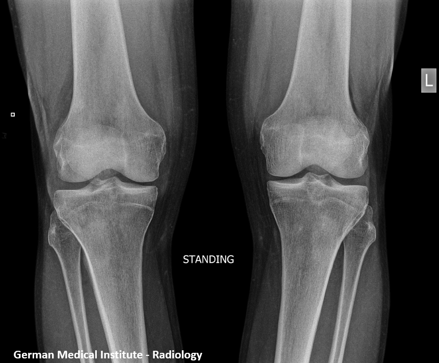Xray-Knees-1 (1)