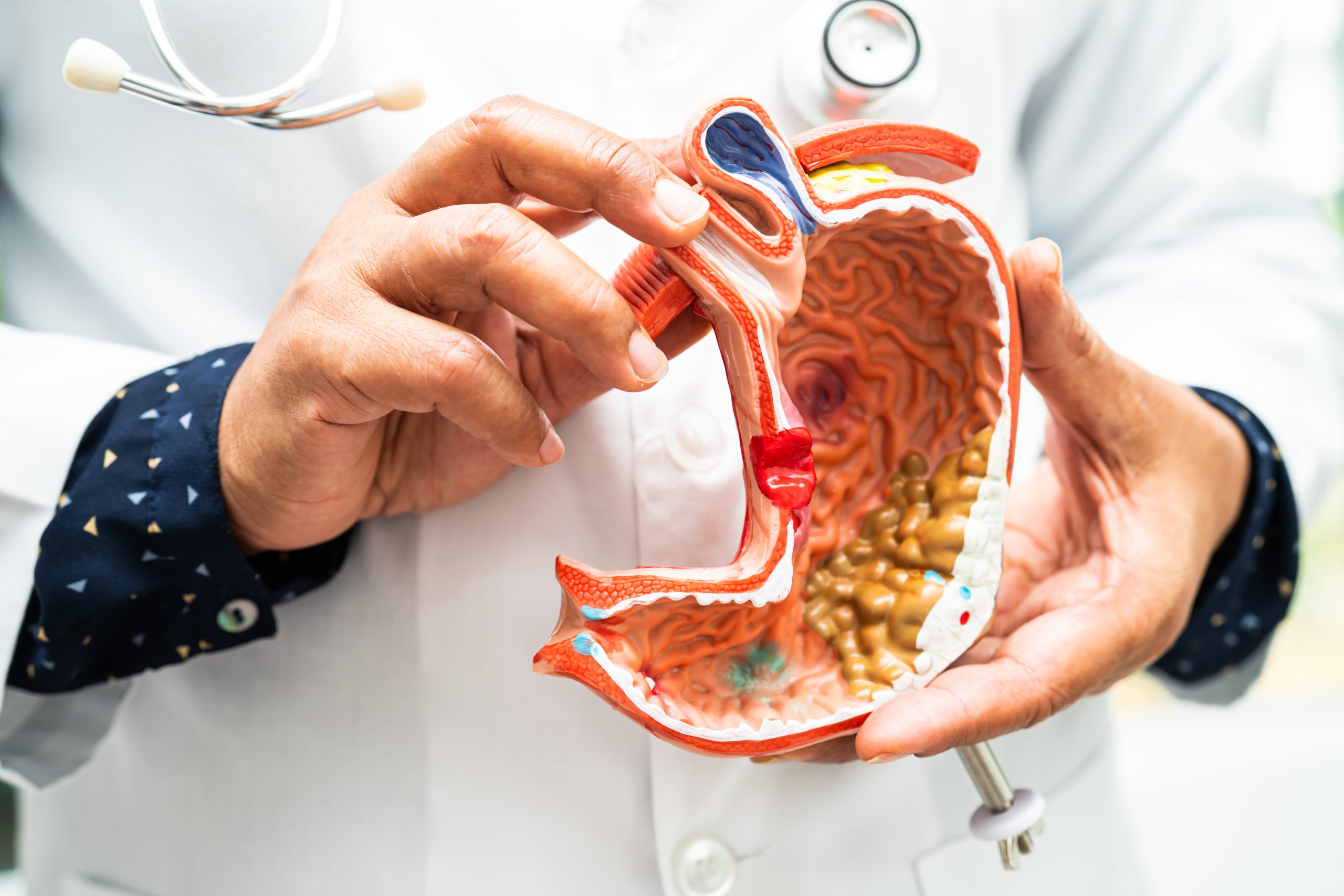 stomach-disease-doctor-holding-anatomy-model-for-2023-11-27-05-10-48-utc-scaled.jpg